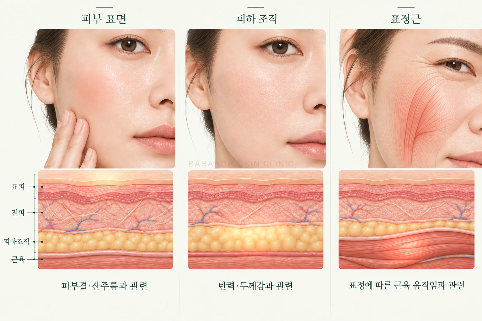 피부와 표정근의 서로 다른 치료 대상을 비교한 그림