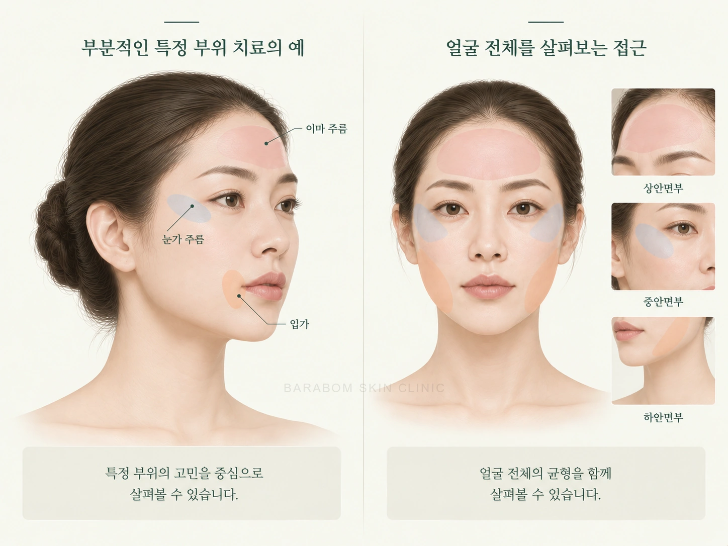 얼굴과 목의 국소 관심 부위를 구분한 그림