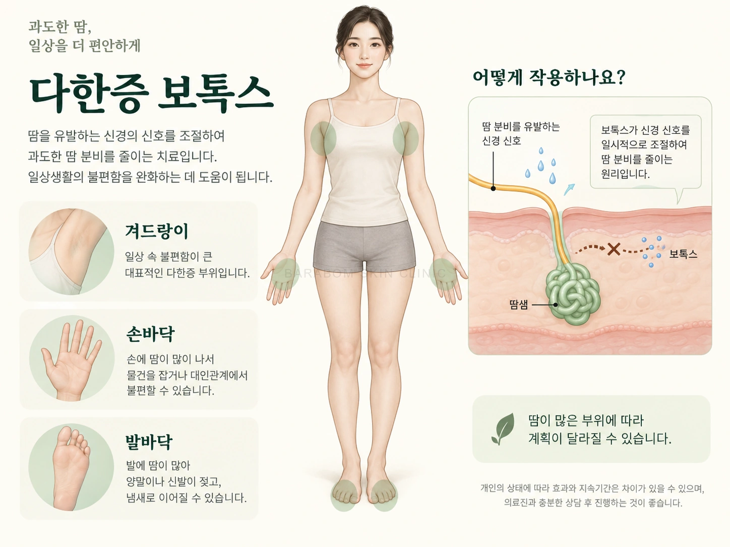 땀샘으로 전달되는 신경 신호와 보톡스의 땀 분비 조절 원리를 설명한 그림