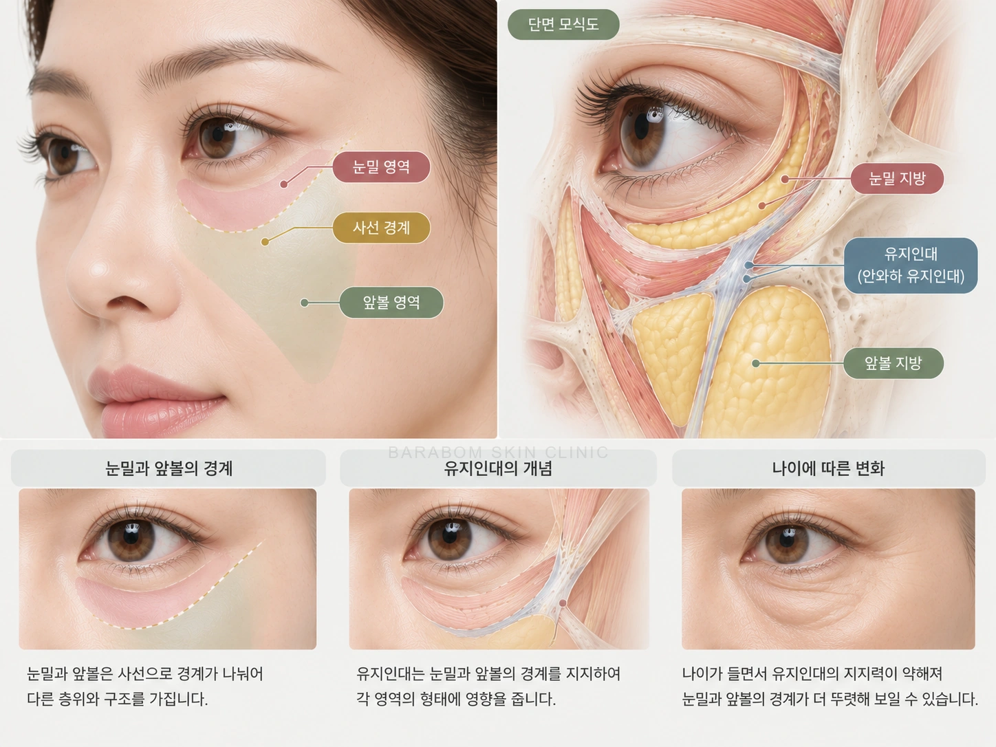 눈밑과 앞볼 사이 경계를 설명한 그림