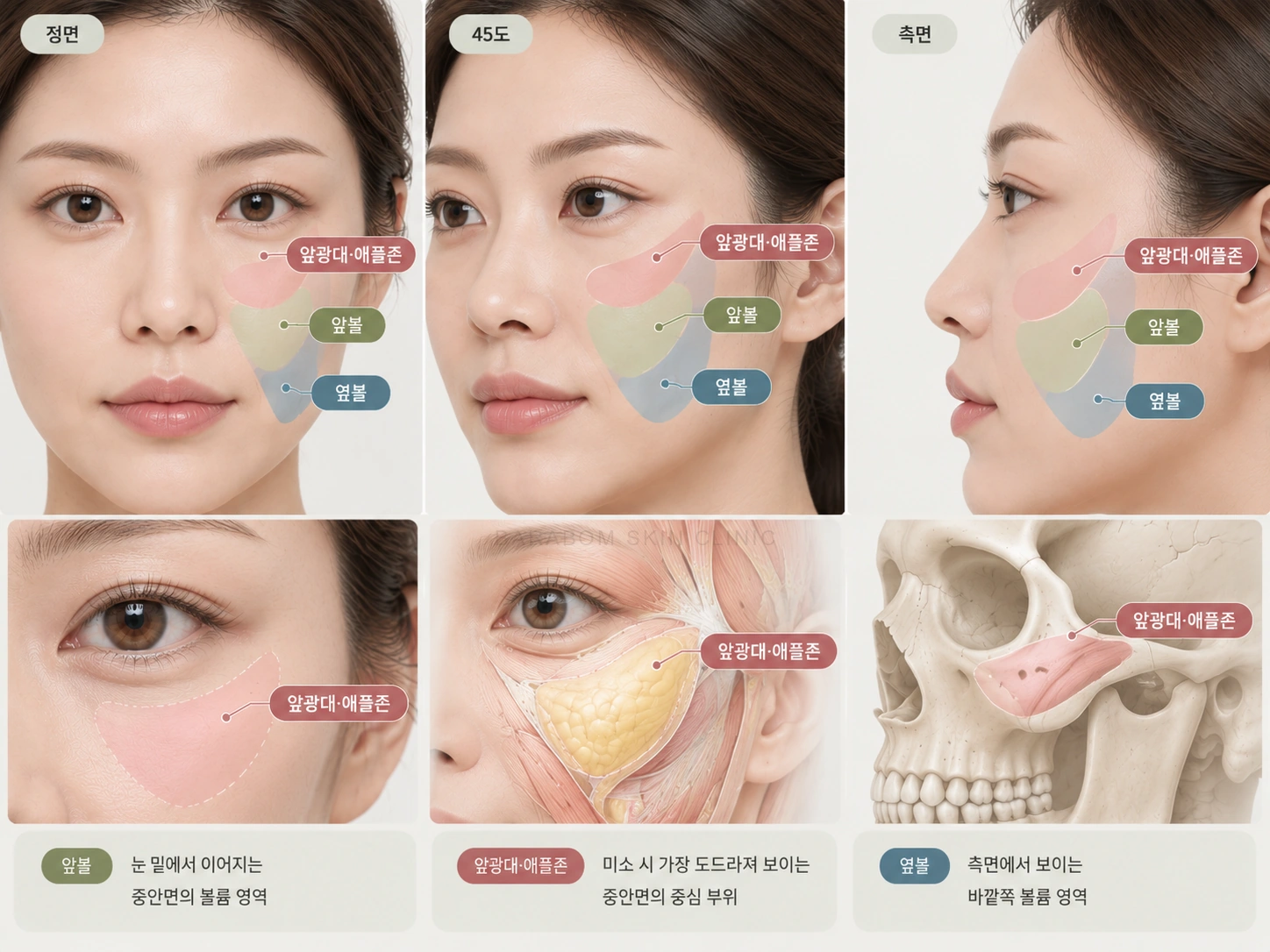 앞광대와 애플존의 위치를 설명한 그림