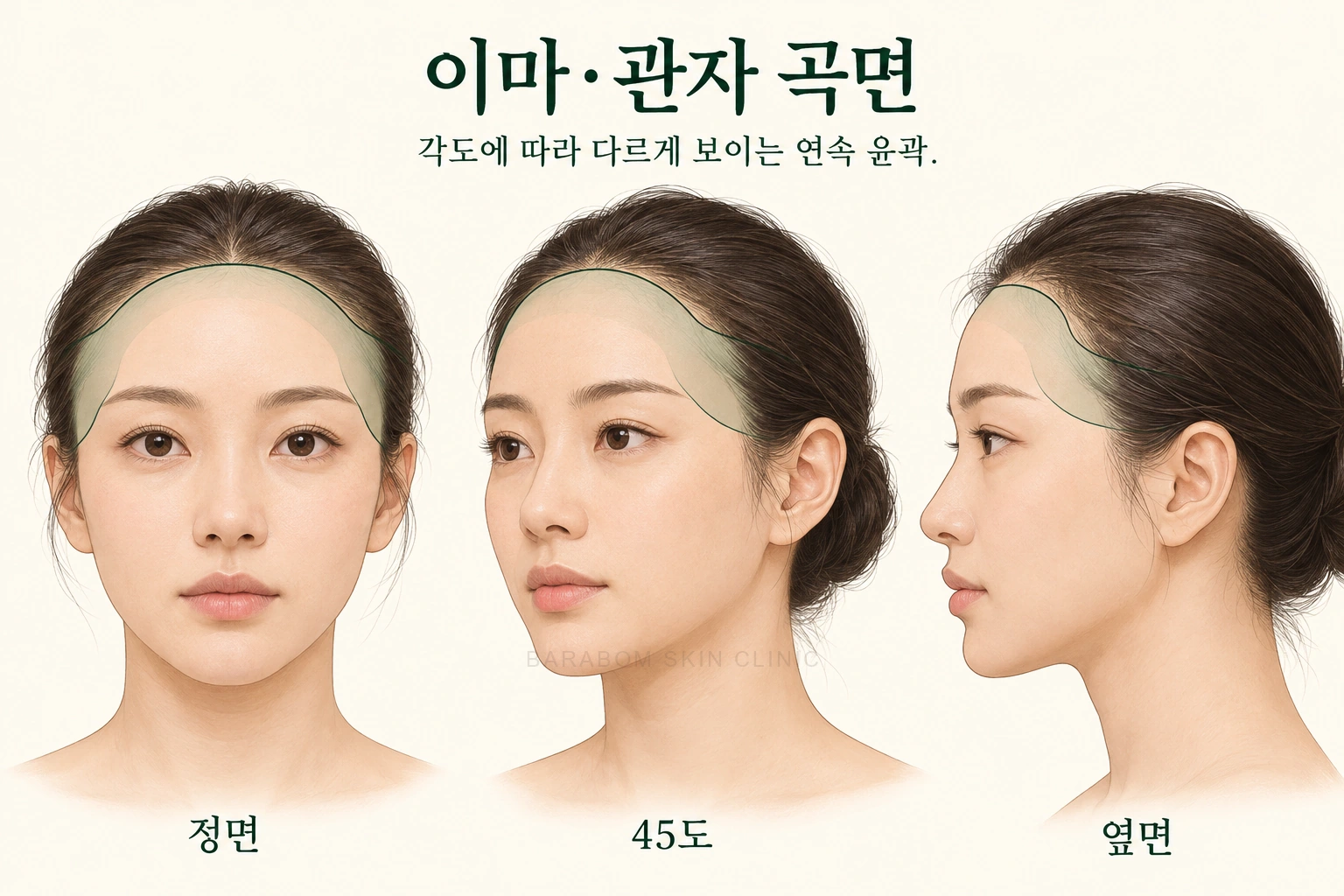 이마와 관자로 이어지는 곡면을 설명한 그림