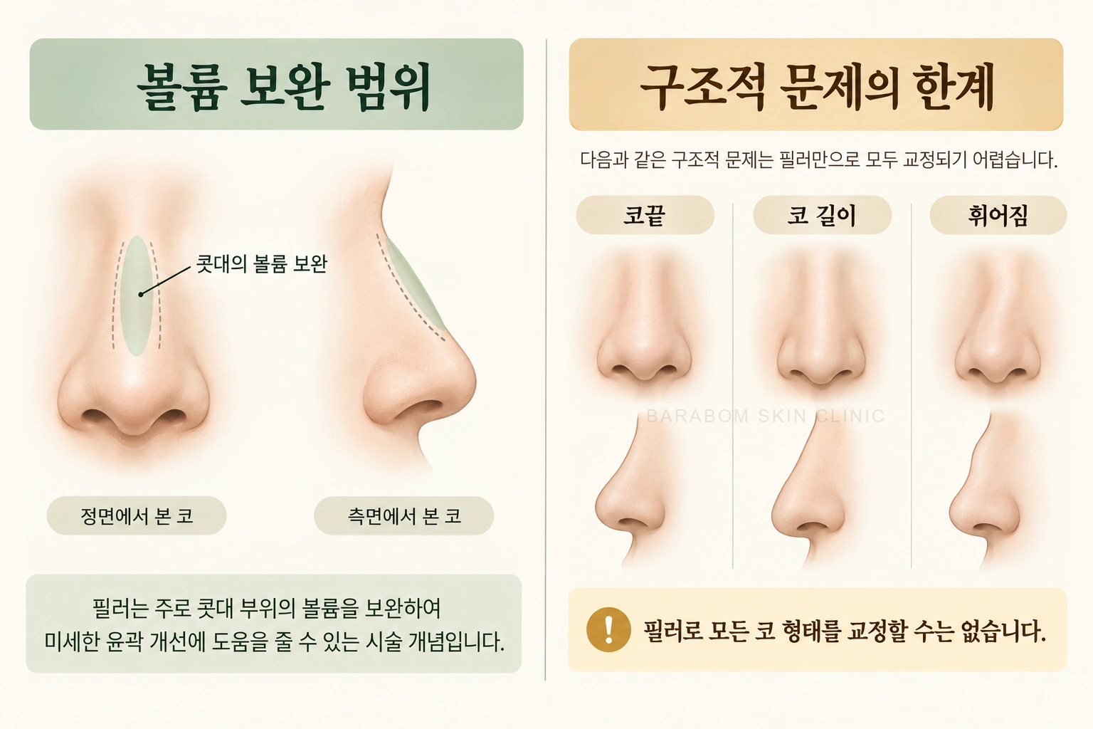 콧대 굴곡과 코끝·길이·휜 구조의 차이를 비교한 그림