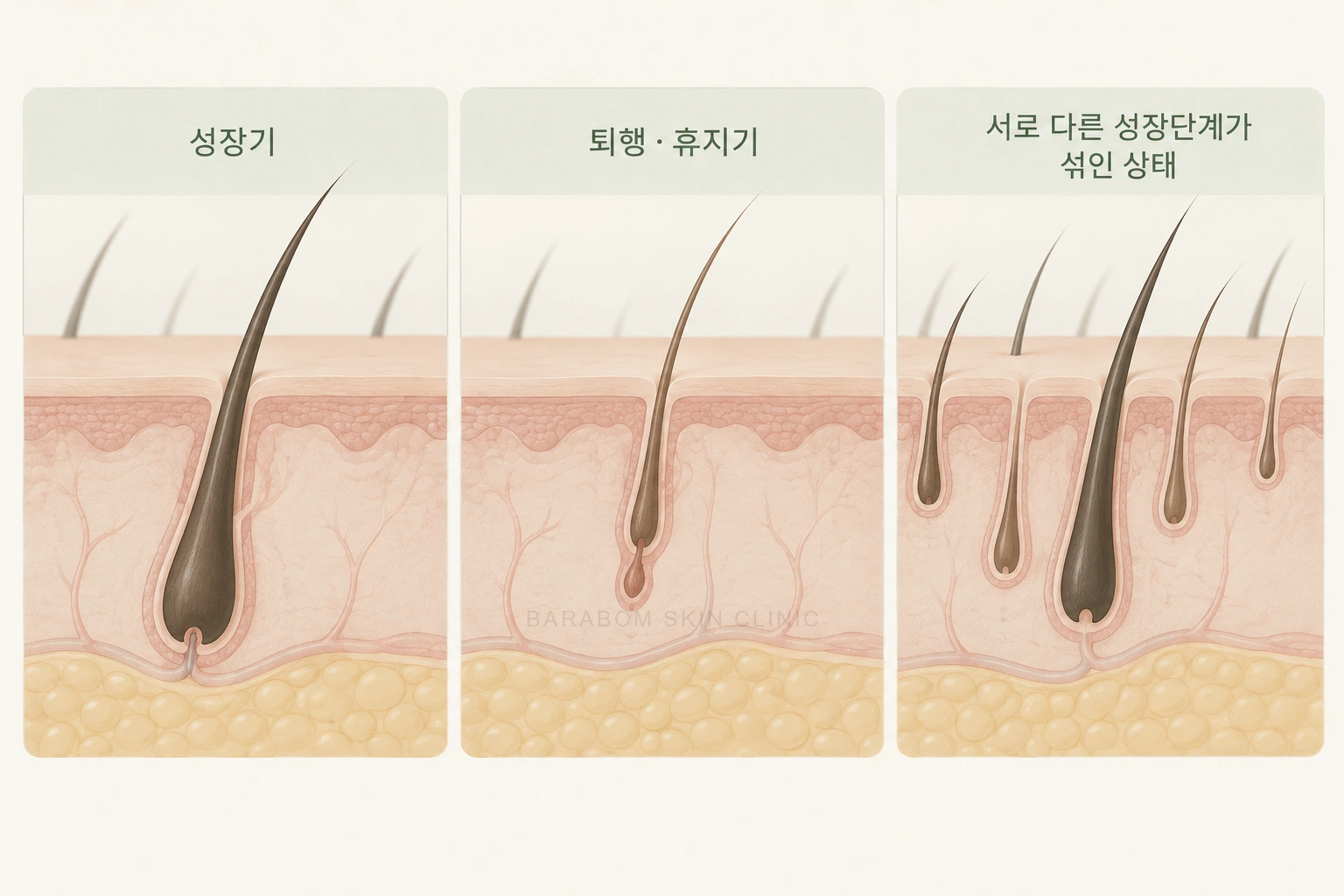 성장기와 퇴행·휴지기, 서로 다른 털 성장단계를 비교한 그림