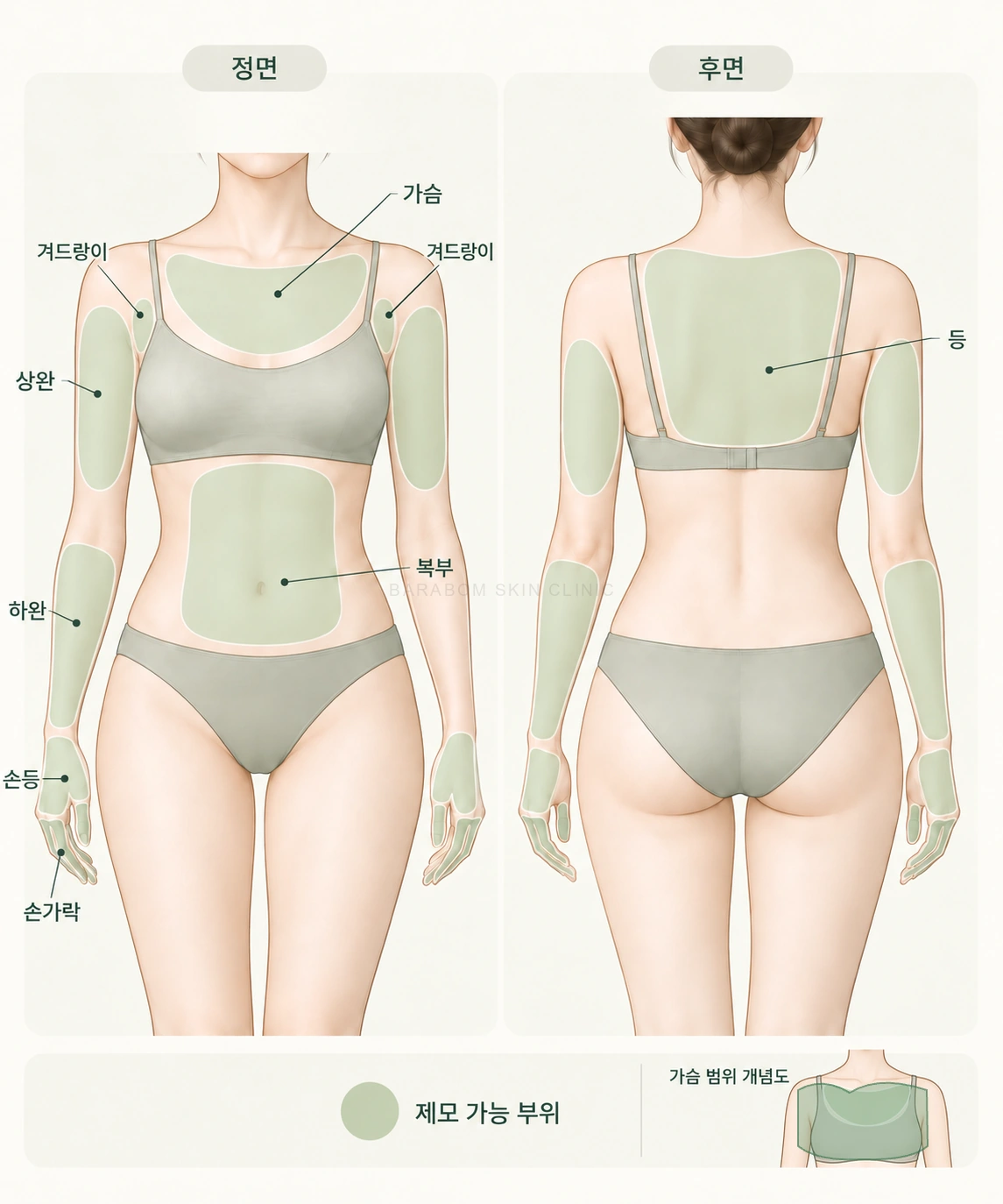 여성 상체 제모 범위를 구분한 그림