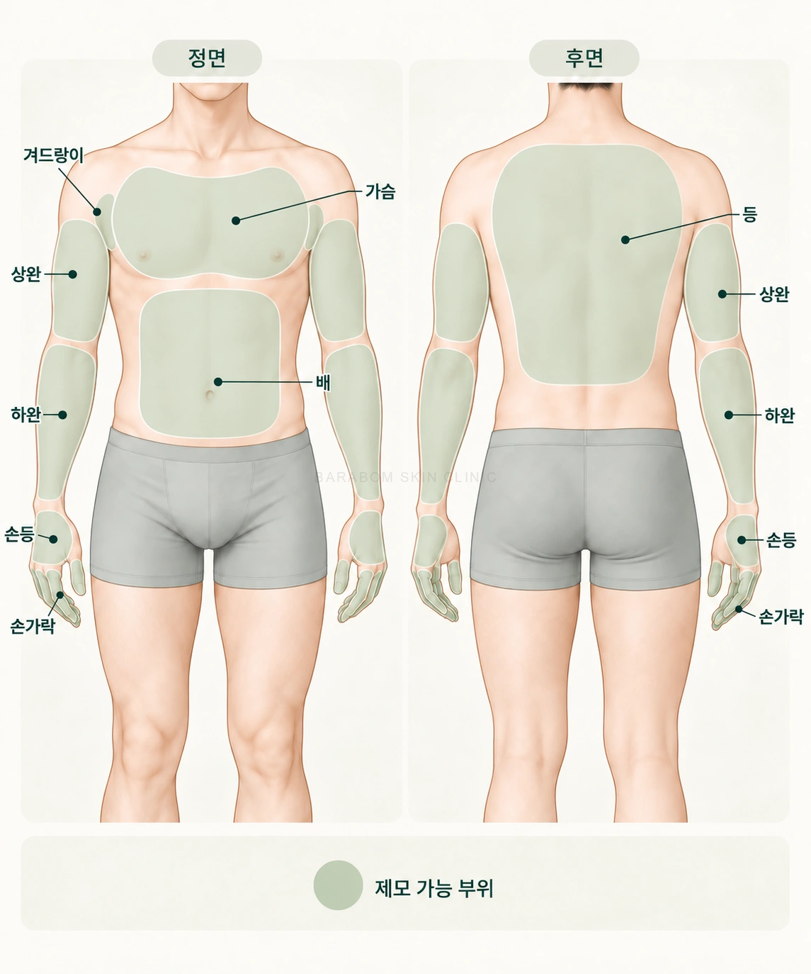 남성 상체 제모 범위를 구분한 그림