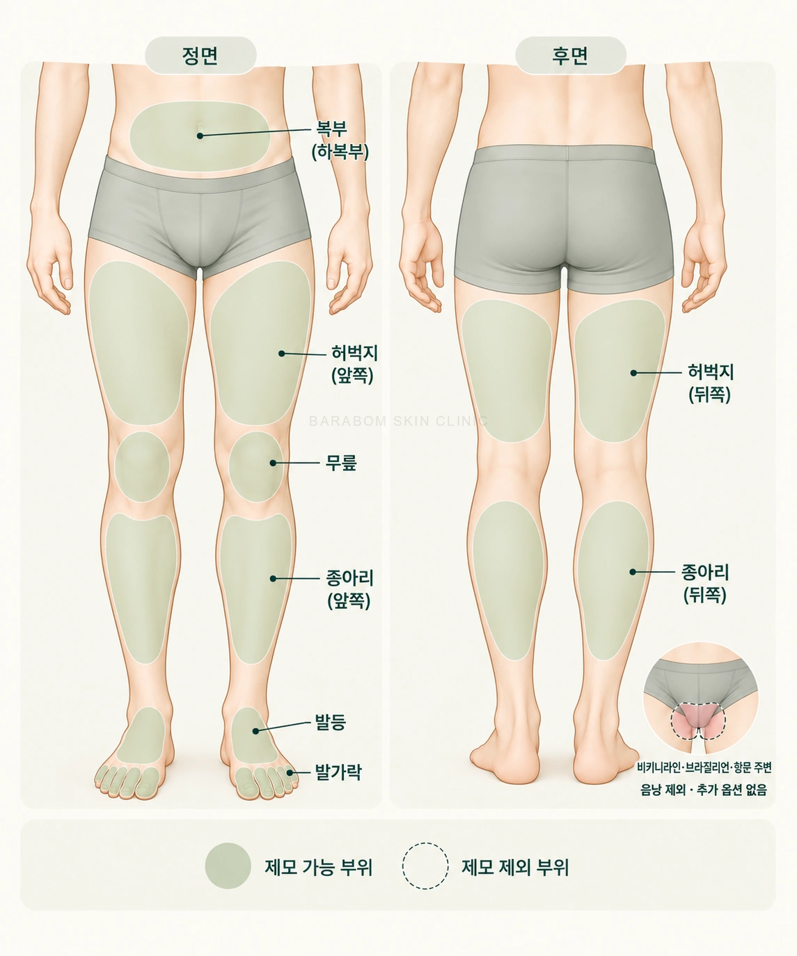 남성 하체 제모 범위를 구분한 그림