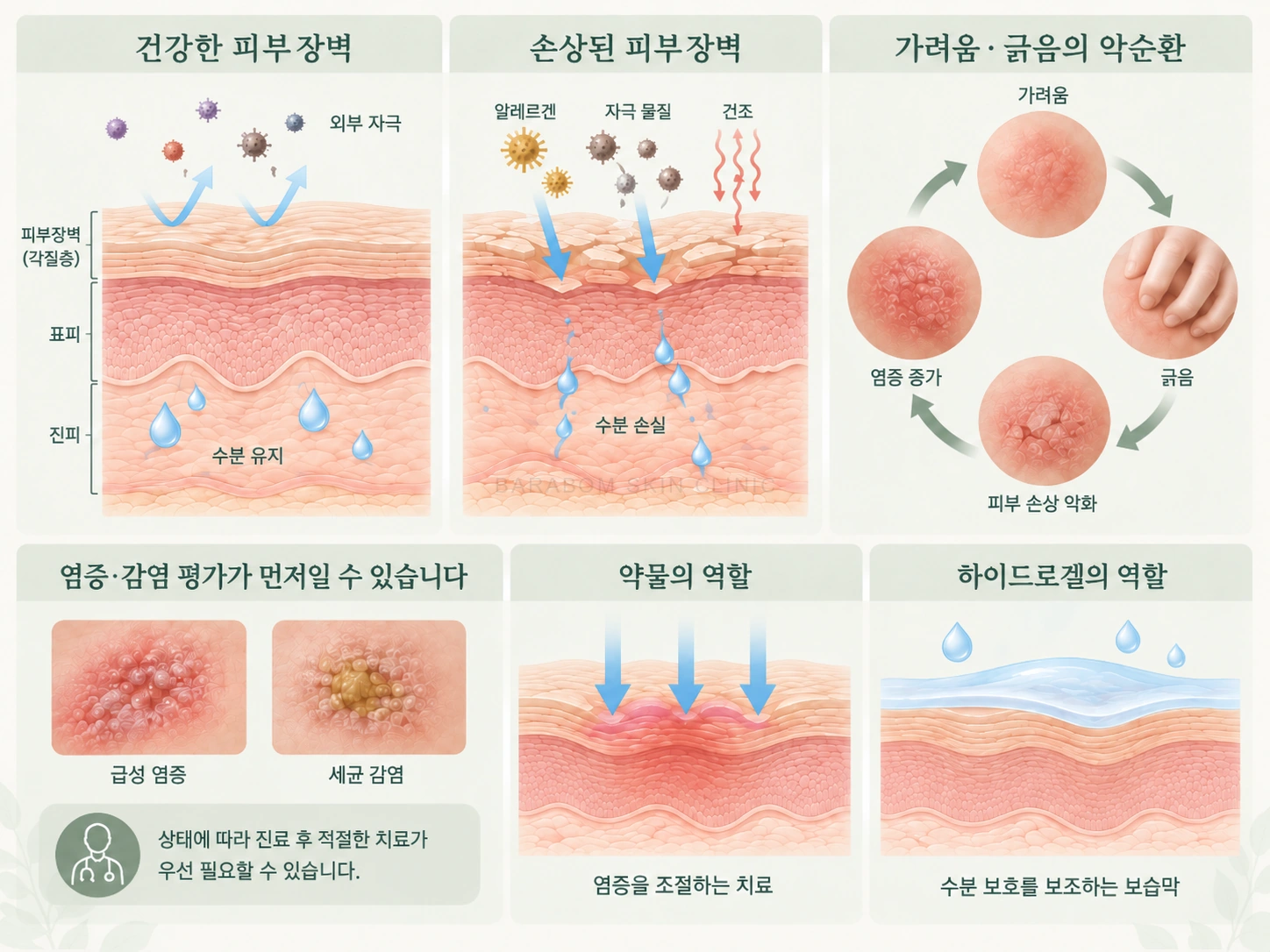 피부 장벽과 가려움·긁기의 관계를 설명한 그림