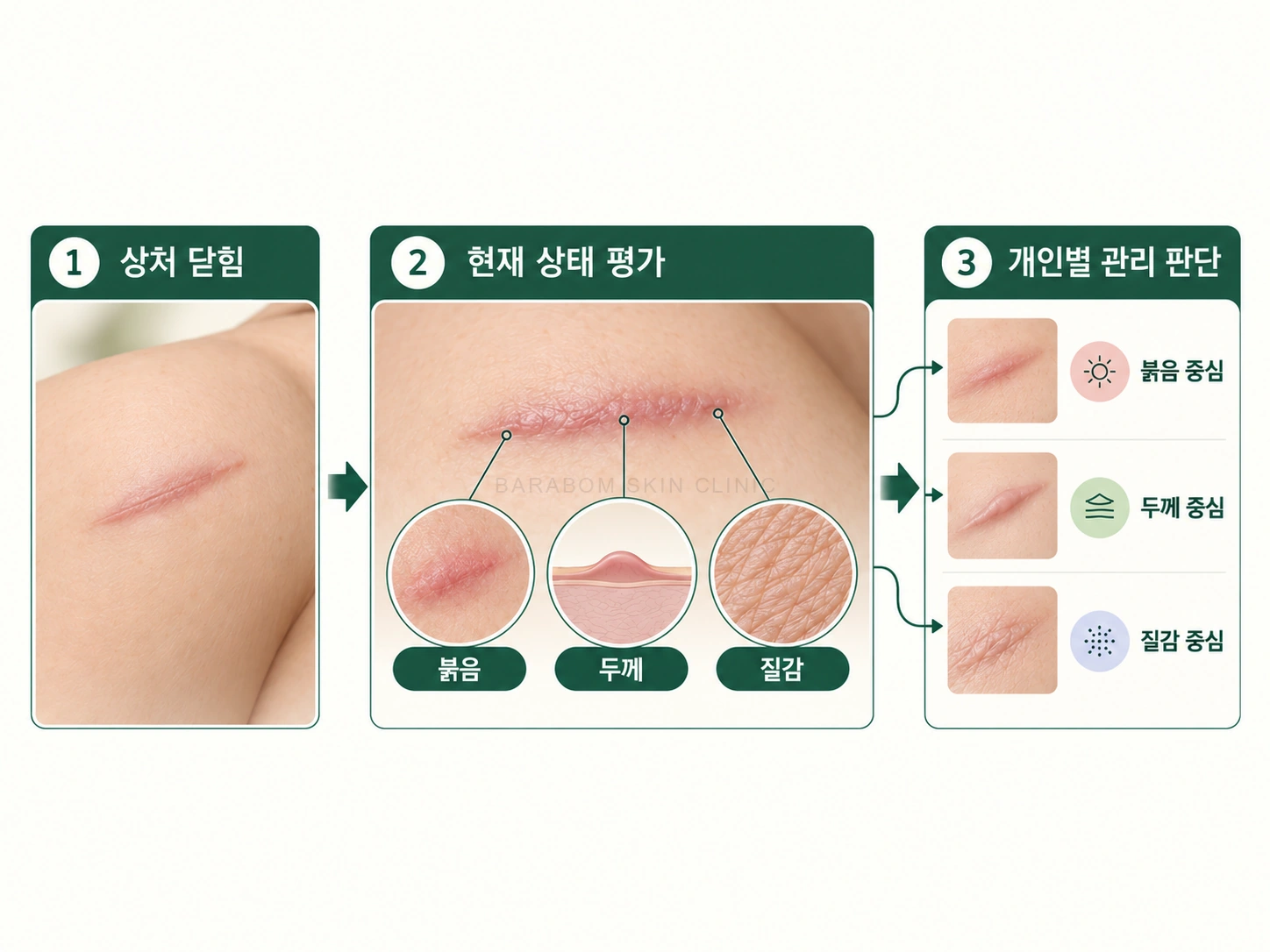 상처가 닫힌 뒤 상태 평가와 개인별 관리 판단으로 이어지는 과정