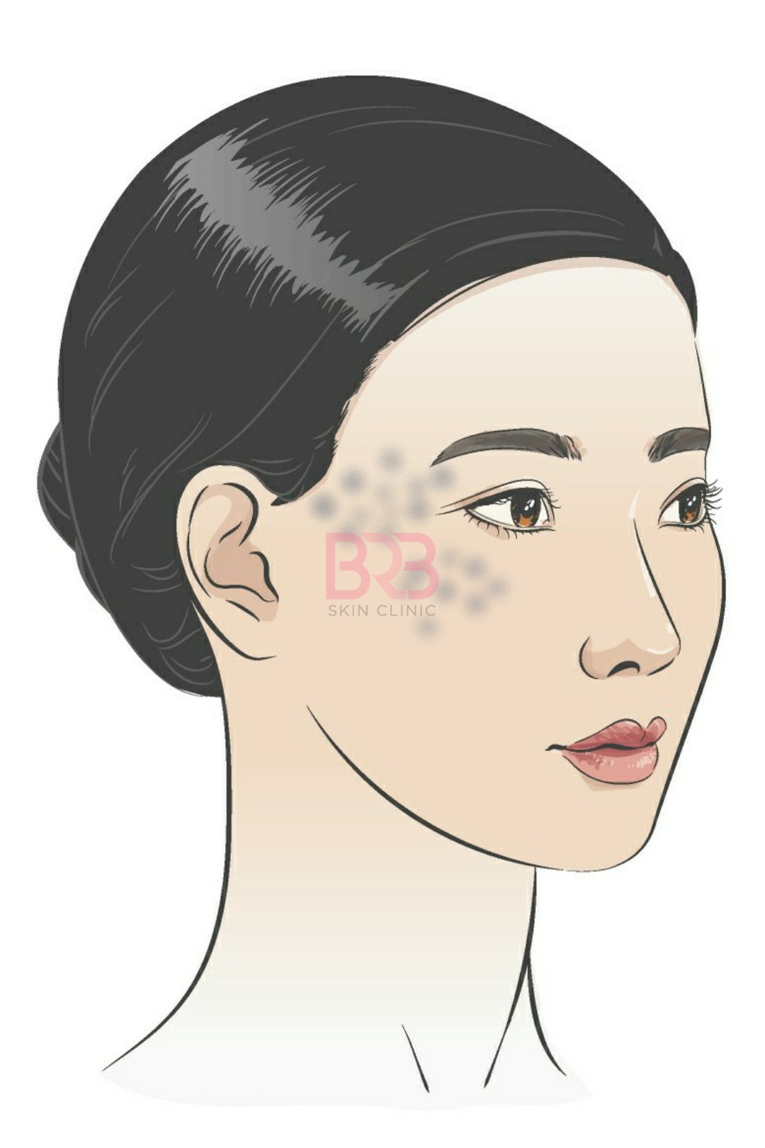 abnom | 바라봄피부과의원